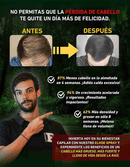 Tónico Capilar OUHOE elixir